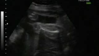 Primeiro Video Da Minha Garotinha