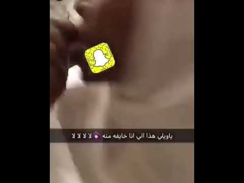 خادمه تريد ان تركب أسنان