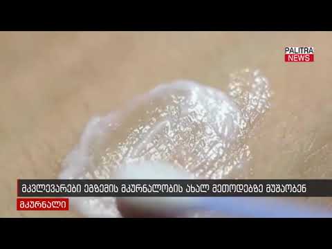 მკვლევარები ეგზემის მკურნალობის ახალ მეთოდებზე მუშაობენ