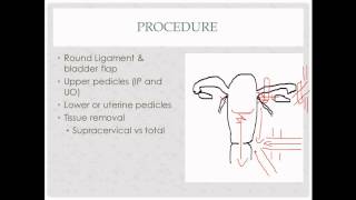 laparoscopic hysterectomy- description, indications and questions