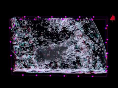 Video: Röntgen-Computertomographie In Den Biowissenschaften