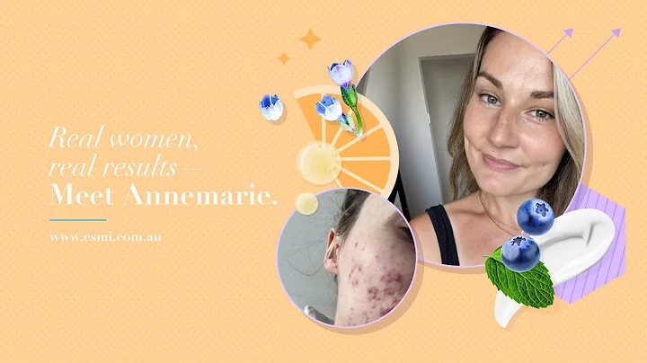 Real Results - Annemarie's Story