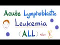 Acute Lymphoblastic Leukemia (ALL) | Down Syndrome | tDt positive