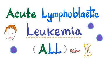 Acute Lymphoblastic Leukemia (ALL) - Symptoms, Pathogenesis, Diagnosis - Down Syndrome - Hematology