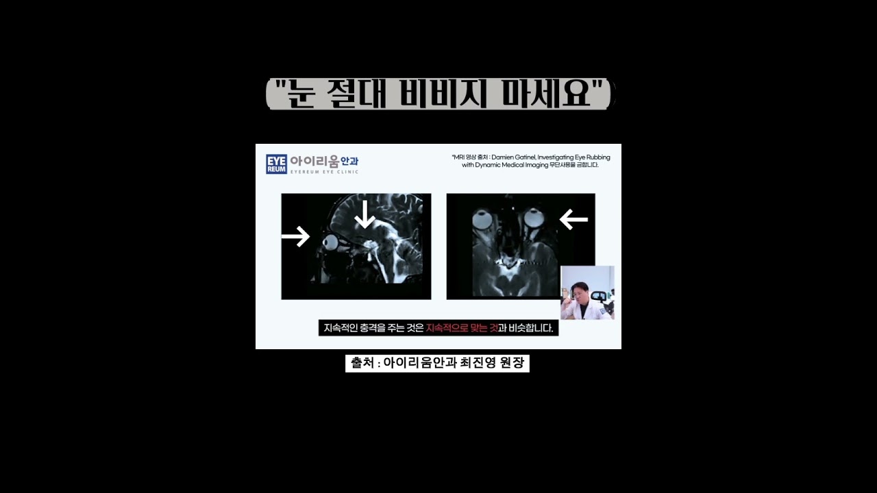 [愛利姆眼科診所] 眼睛健康管理：眼睛絕對不要揉搓！！ - 愛利姆眼科 崔真英院長