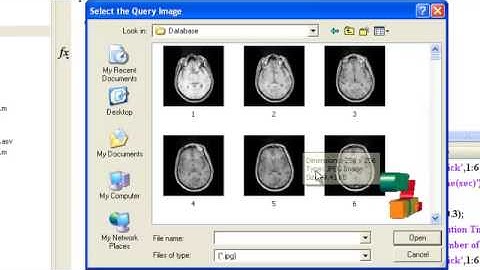 Final Year Projects | Content-Based Microscopic Image Retrieval System for Multi-Image Queries