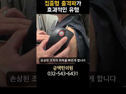 집중형 충격파가 맞는 경우