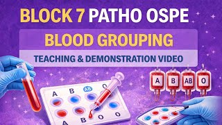 Block 7 Pathology OSPE | ABO Blood Grouping | Teaching &amp; Practical Demonstration | UHS Exam OSPE 