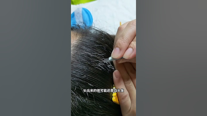 白头发能拔掉吗，最好不要！