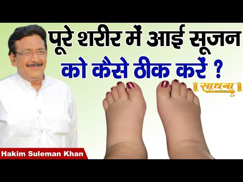 पूरे शरीर में आई सूजन को कैसे ठीक करें ? Hakim Suleman Khan | Sadhna TV