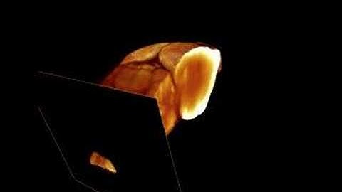 How to make a brain transparent
