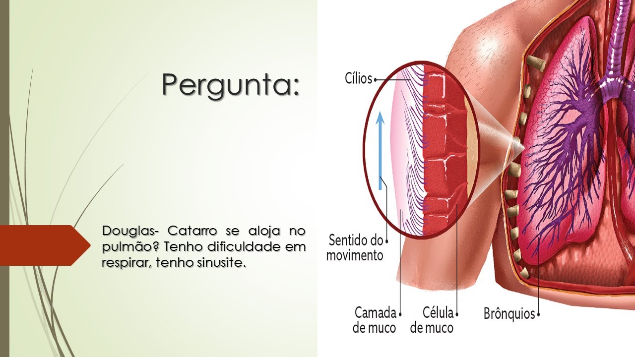 Catarro se aloja no pulmão? | Tenho dificuldade em respirar e tenho ...