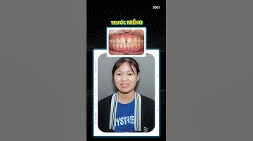 Bạn đã sẵn sàng bắt đầu hành trình thay đổi nụ cười của mình chưa?