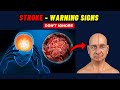 Warning signs of stroke  early signs of stroke  stroke warning signs