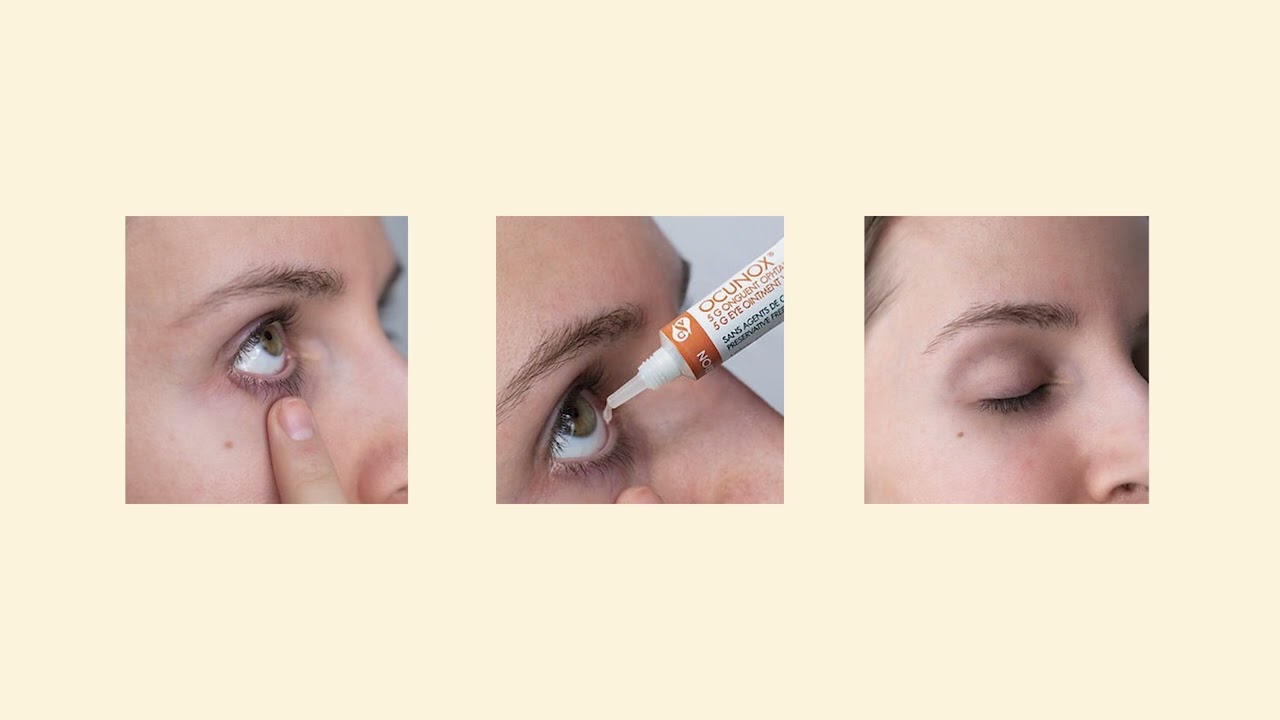 OCUNOX Eye Ointment – Overnight Relief for Severe Dry Eyes & Lagophthalmos