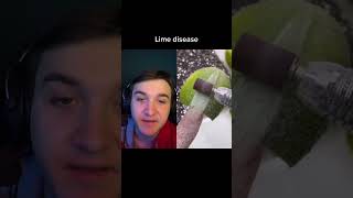 Anyone Ever Heard Of Lime Disease?