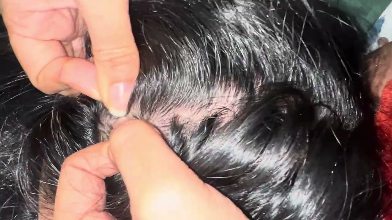 😇😇Scalp Scratching, Hair Care & Lice Checking😴😴 