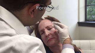 Botox vs. Dysport