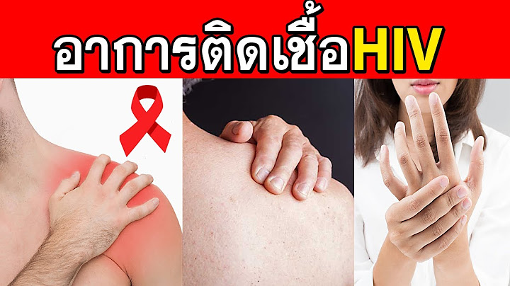 จะรู้ได้ไงว่าติดเชื้อ HIV ............อาการคนติดเอดส์ (ลองสังเกตุตามนี้)