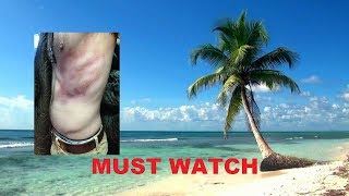 Worst Belly Flop Ever