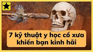 7 kỹ thuật y học cổ xưa khiến bạn phải kinh hãi