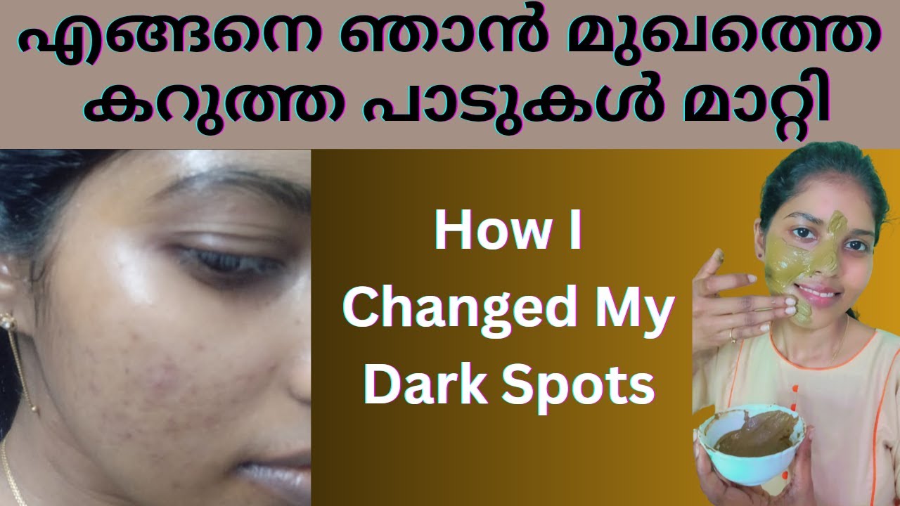 How To Get Clear Skin Naturally At Home | Malayalam - YouTube