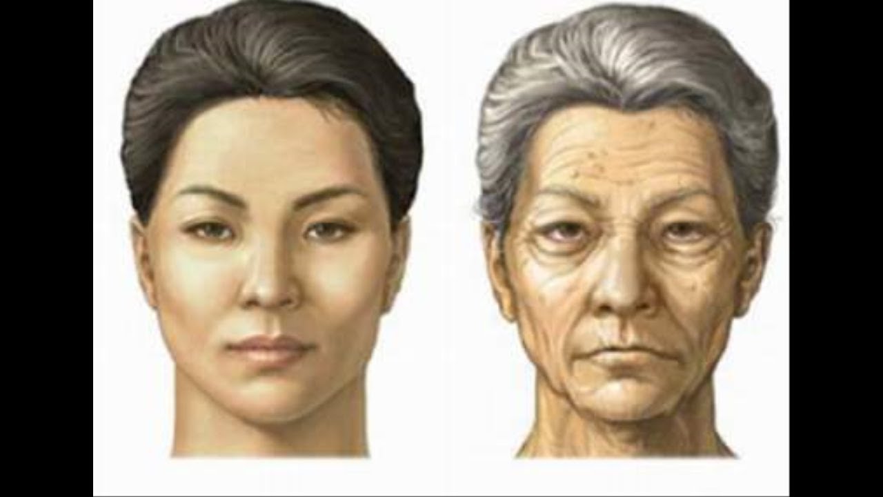 Возрастные изменения у мужчин. Возрастные изменения кожи. Возрастные изменения кожи лица. Старение лица женщины. Старение человека.