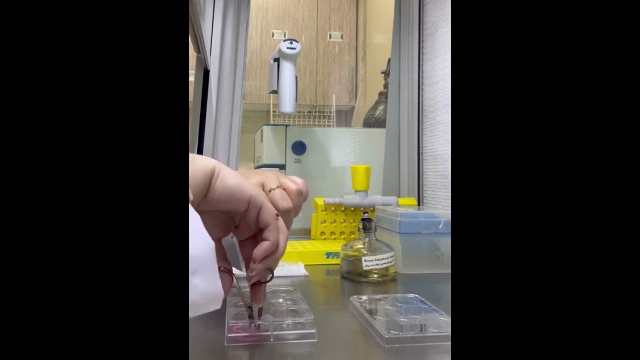 Cell Culture: (MEF) Mouse embryonic fibroblast stem cell