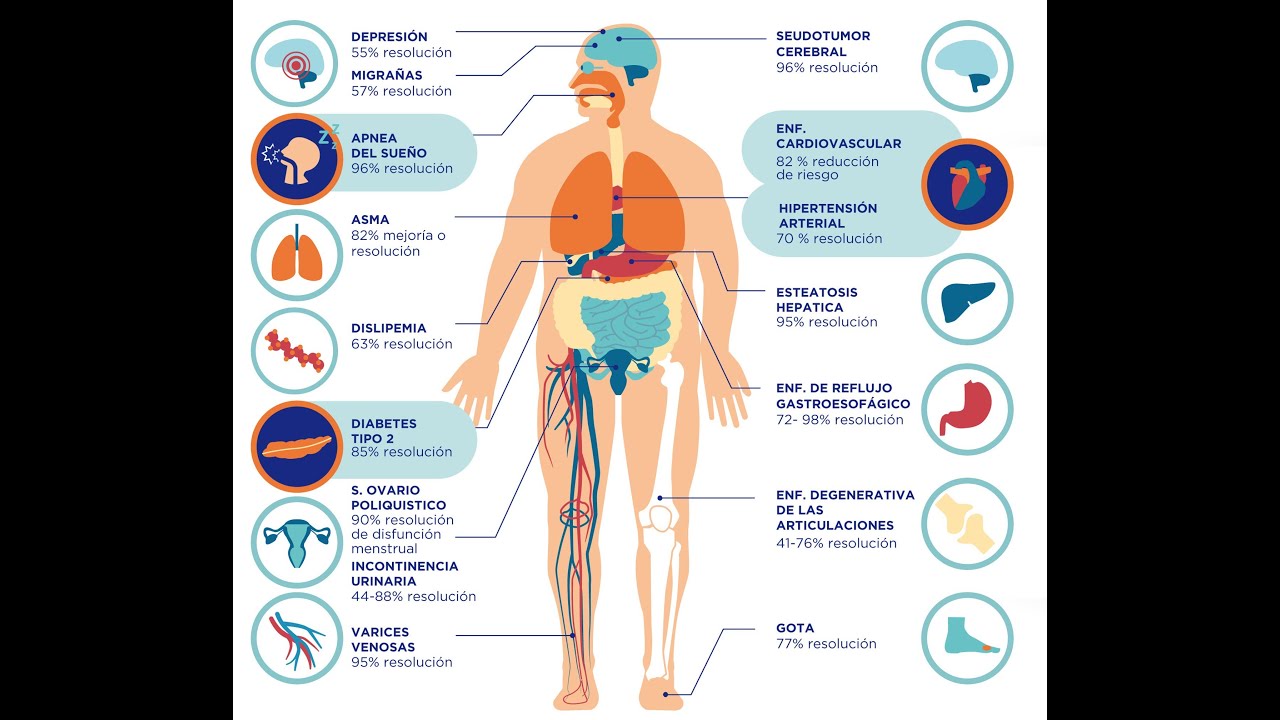 Разрешение заболеваний после бариатрической хирургии