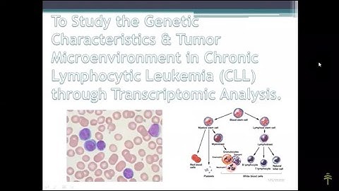 Tumor Microenvironment in Chronic Lymphocytic Leukemia through Transcriptomic Analysis