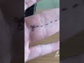 【ドクターリアクション】指が合体してる合指症#合指症