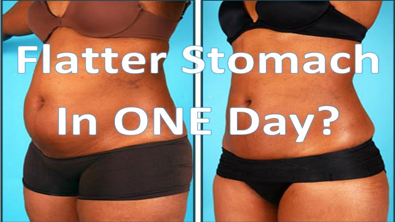 Abdominal Plastic Surgery Cost Seattle WA Dr. Brian Windle YouTube