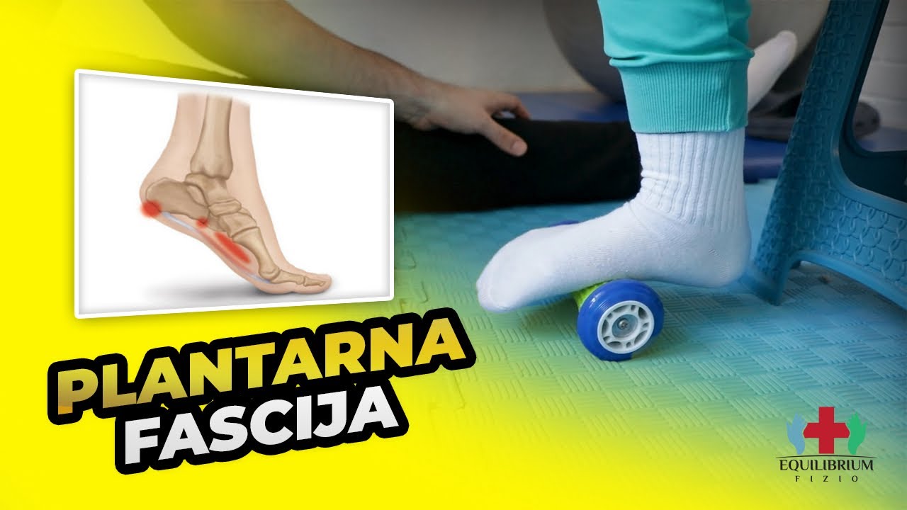Kako se rešiti bolova u stopalu i plantarnog fascitisa – Vežbe i saveti! #plantarnafascija #eflife