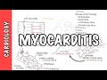 Myocarditis - causes, pathophysiology, investigation and treatment