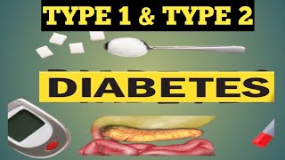 This One Test Could Save You from Diabetes Type 1 or Type 2–Which One R You at Risk For?High Sugar 