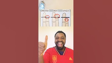 #cute #braintest #duet #triviatricks #mindbendingquiz #mathquiz #riddlejourney #comedy #games