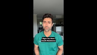 Signs You Might Have Insulin Resistance