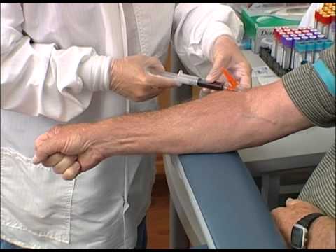 How to perform a venipuncture using a