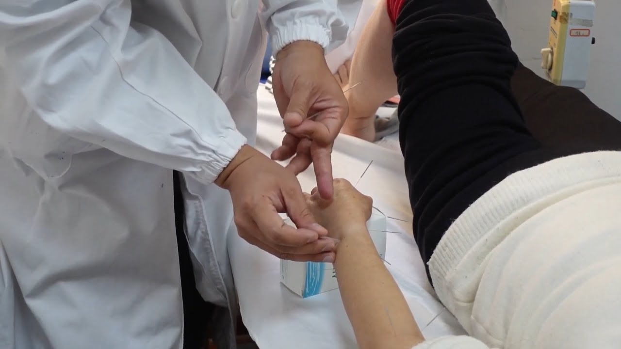 ASMR Acupuncture | Shanghai Hospital of Traditional Chinese Medicine | Unintentional ASMR