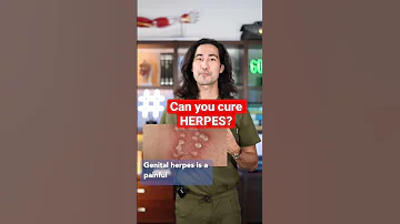 Can You CURE HERPES 