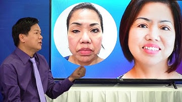 Có nên nâng mũi và cắt mí mắt cùng lúc?