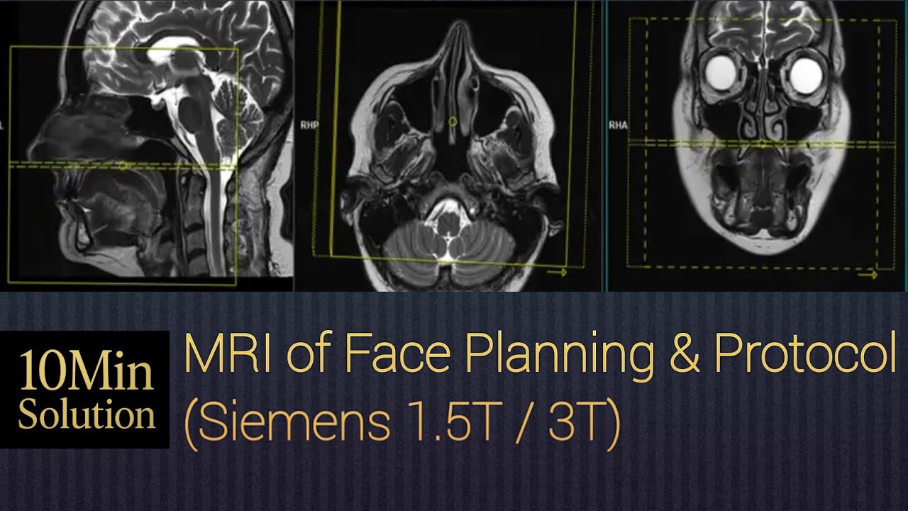 MRI of Face | Step-by-Step Positioning & Sequences Guide