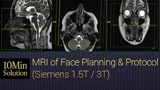 MRI of Face | Step-by-Step Positioning & Sequences Guide screenshot 3