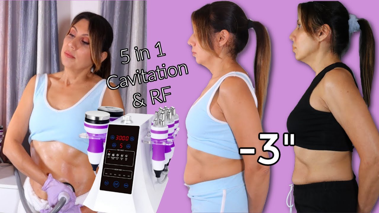 HONEST REVIEW* At home Claire 5 In 1 Cavitation Machine + Before And After  Results