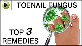 Toenail Fungus - Natural Ayurvedic Home Remedies screenshot 5