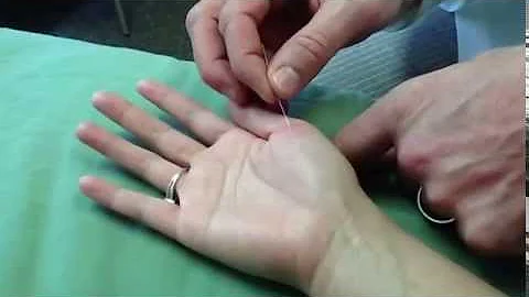 Master Tung's Neck & Shoulder Pain (Xiaojie) Brad ...