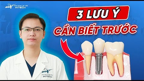 3 Lưu Ý Quan Trọng Khi Trồng Răng Implant Nhất Định Bạn Phải Biết