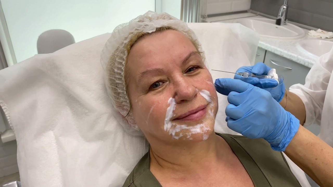 Контурная пластика Amalain hard