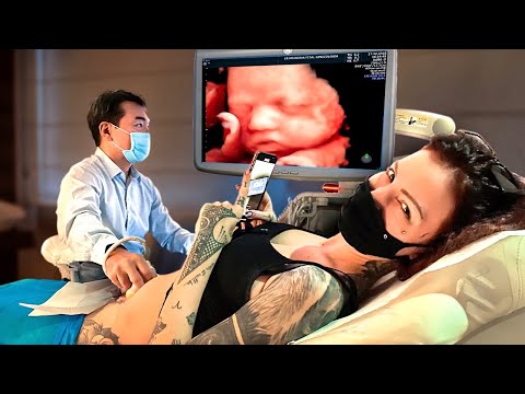 CONSEGUIMOS VER O ROSTO DO NOSSO NOVO BEBÊ!!!