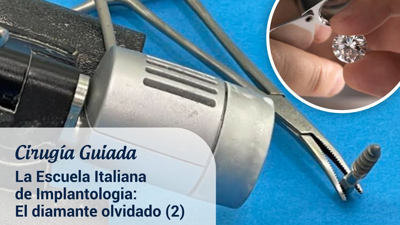 La escuela italiana de implantolog a el diamante olvidado 2 